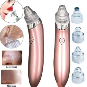 extractor-de-puntos-negros